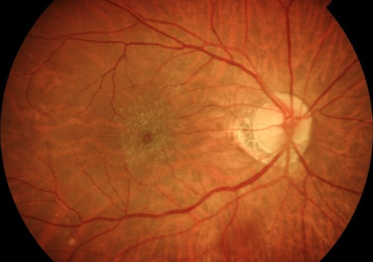 created by TOPCON NW500