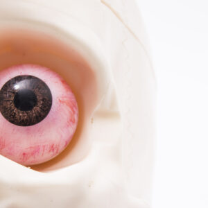 Chinese Study Highlights Posterior Uveitis in Ocular Syphilis