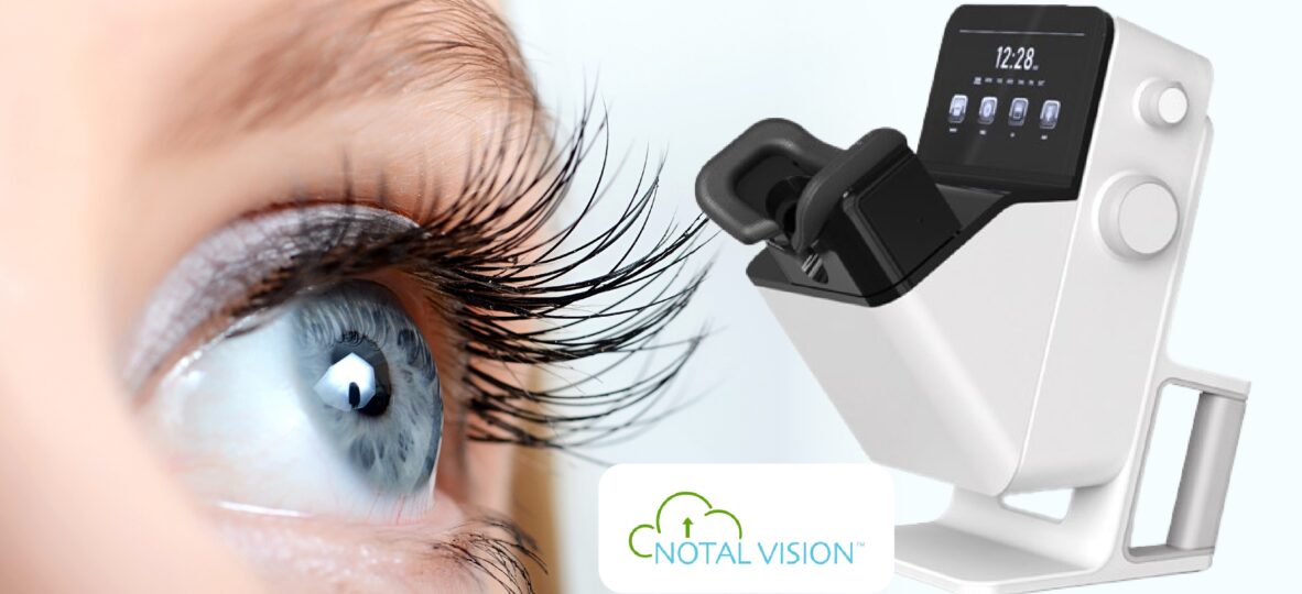 AI Powered Notal Vision SCANLY_THUMBNAIL