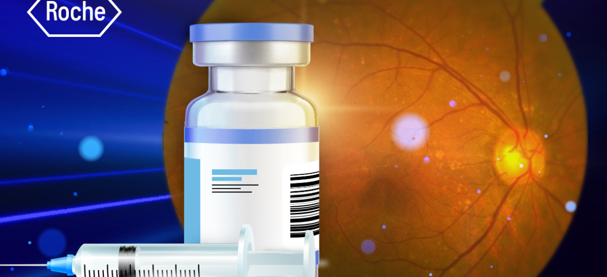 Thumbnail website _ 1200x675_Roche Vabysmo Shows Promise in Treating Polypoidal Choroidal Vasculopathy (PCV) in Asian Patients_fix