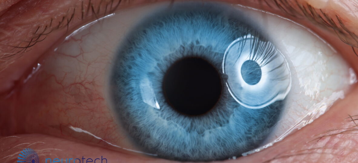 Website thumbnail   2