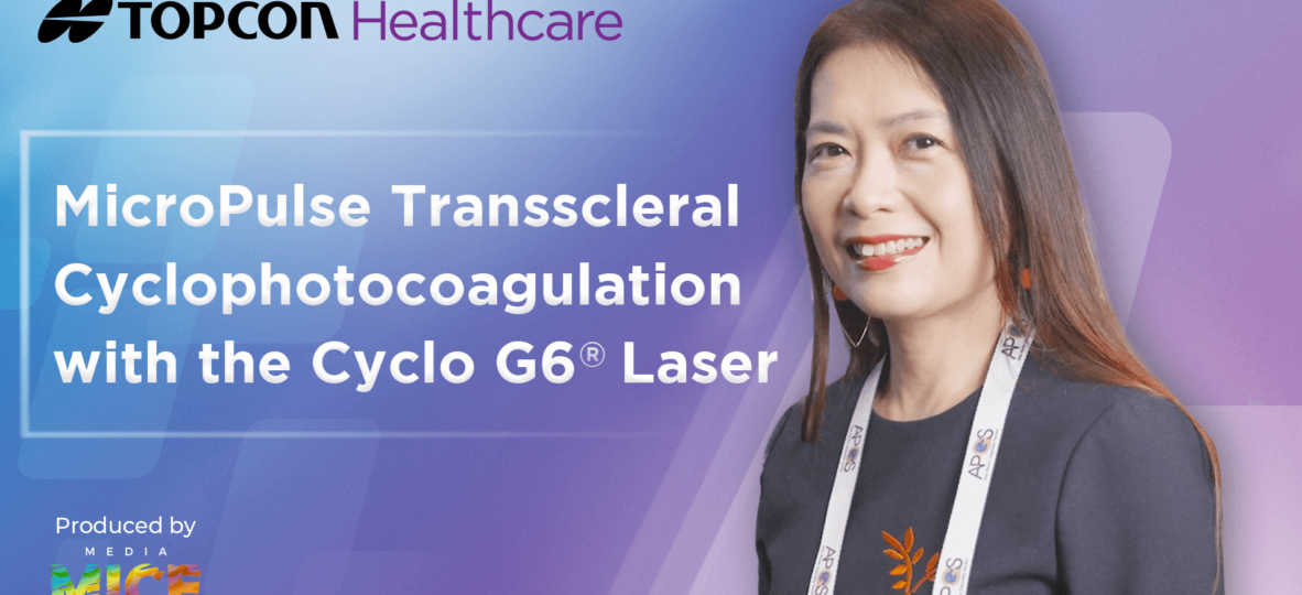 [Topcon] APGC KOL interview Dr. Ho Ching Lin thumbnail MicroPulse Transscleral Cyclophotocoagulation with the Cyclo G6 Laser (1)