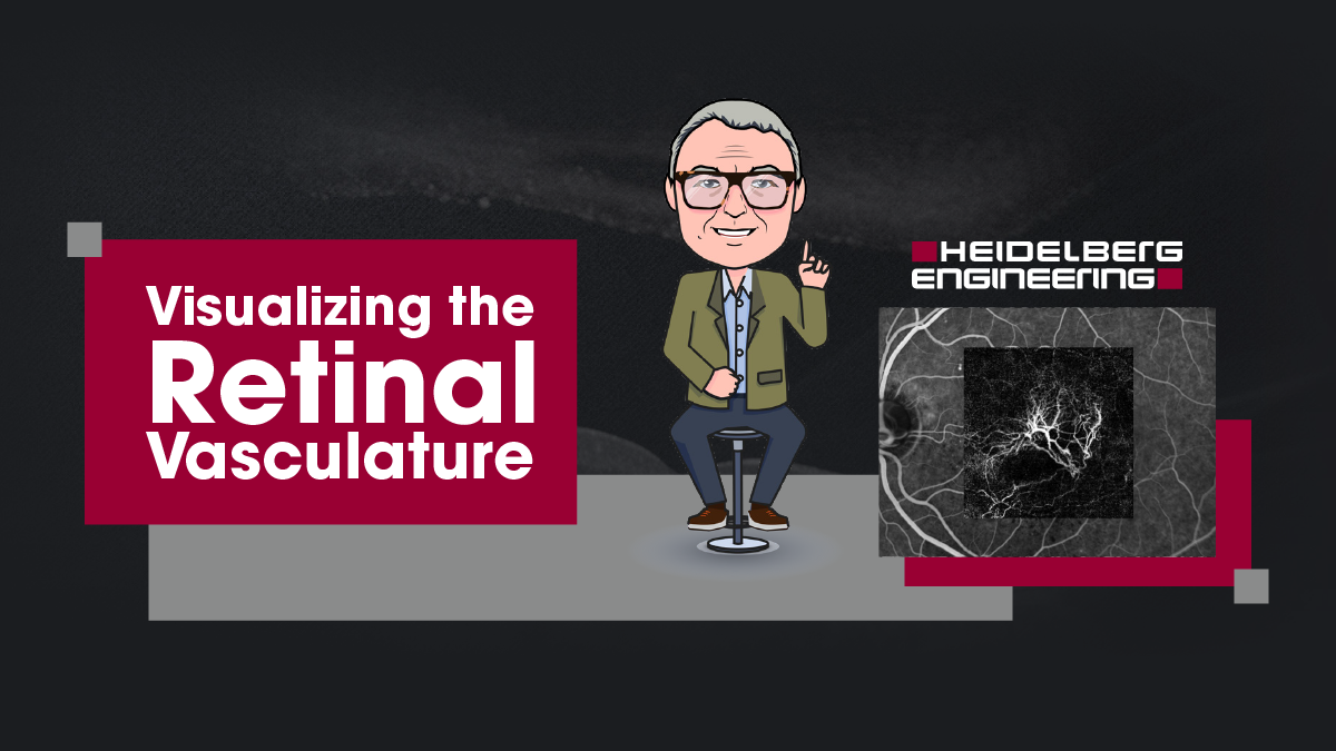 [Heidelberg] Website article thumbnail 01