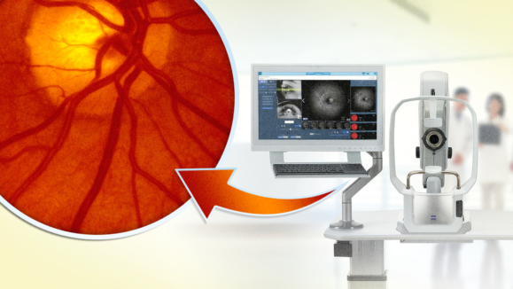 Clarus 700 China Approval
