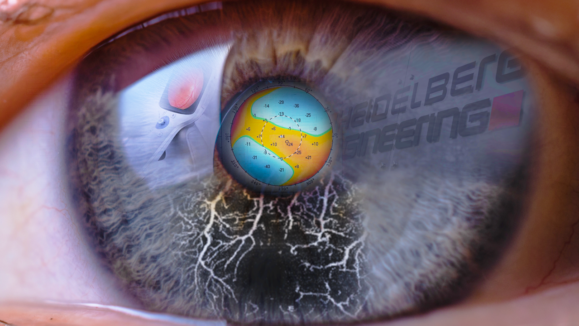 Heidelberg_zinzerlab_thumbnail 1