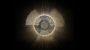 Radiation Maculopathy Formally _thumbnail