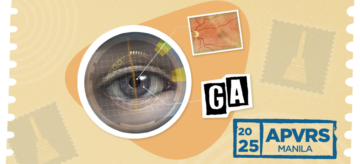 Geographic atrophy eye imaging graphic APVRS