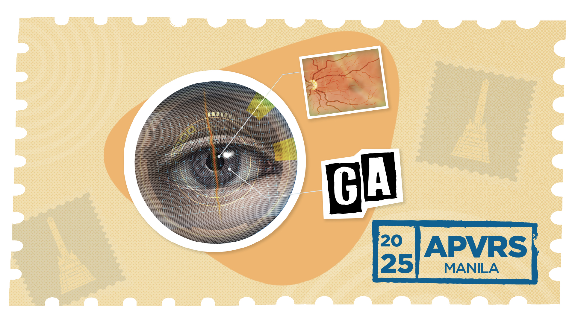 Geographic atrophy eye imaging graphic APVRS