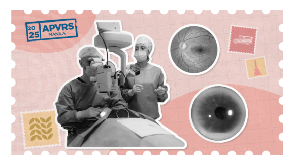 Cataract surgery scene with retinal imaging