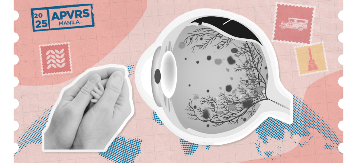 ophthalmologists perform oct imaging on a patient