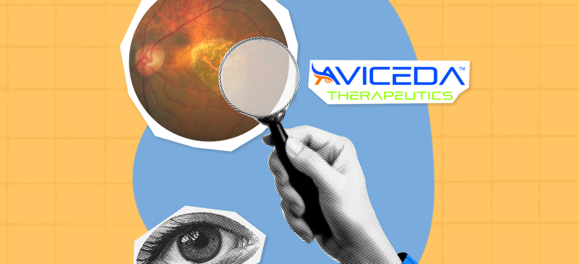 Aviceda Therapeutics GA drug into Phase II trials despite endpoint miss