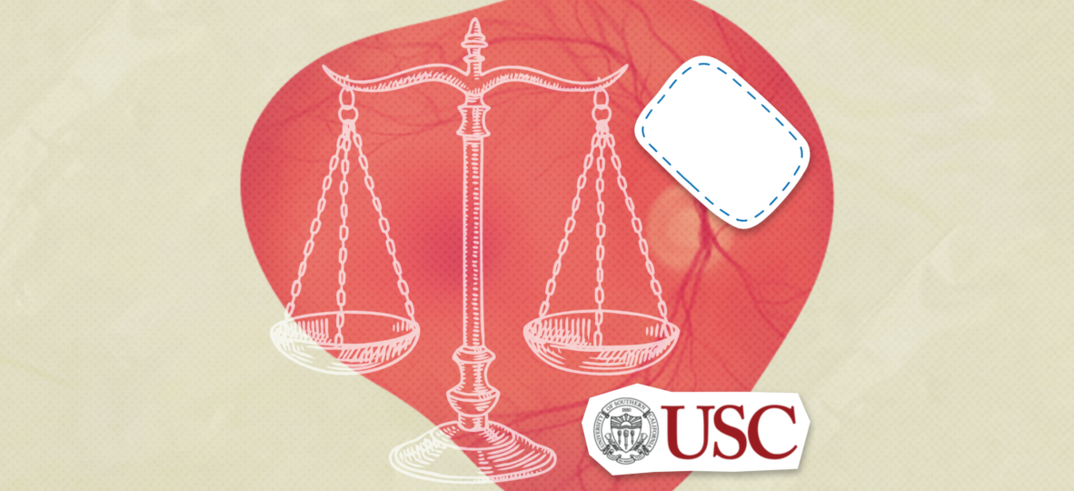 USC researchers test stem cell-based retinal implant for dry AMD by Regenerative Patch Technologies in Phase IIb trial