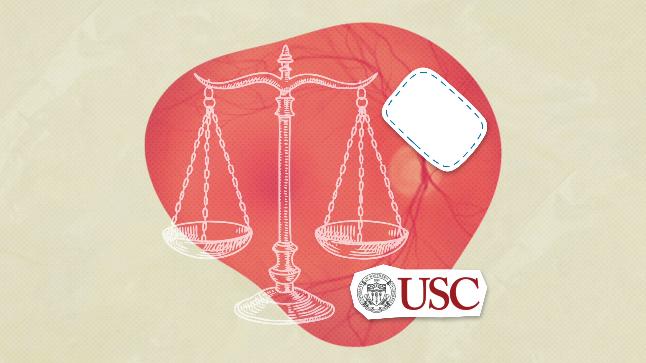 USC researchers test stem cell-based retinal implant for dry AMD by Regenerative Patch Technologies in Phase IIb trial