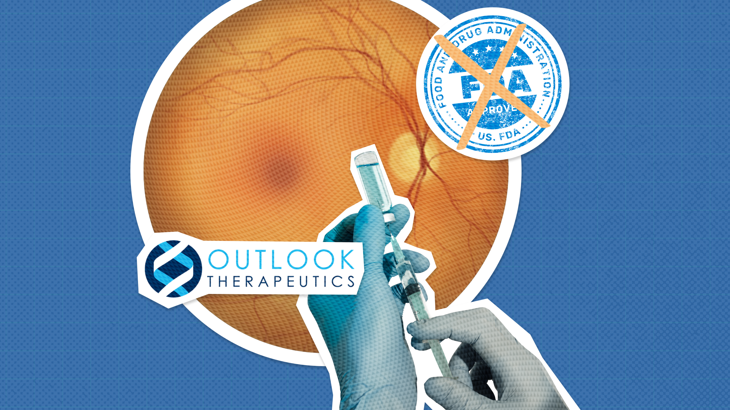 Outlook Therapeutics receives FDA Complete Response Letter for their LYTENAVA